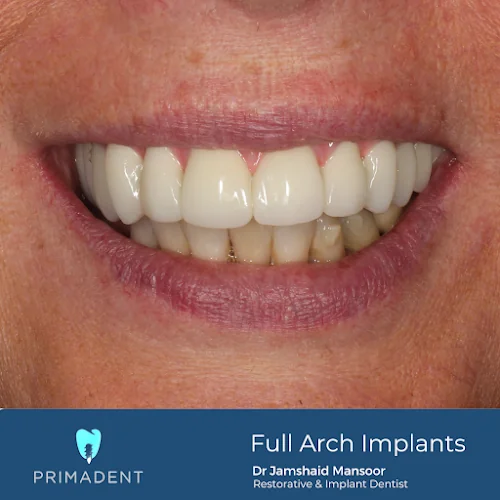 Primadent Dental - Cosmetic dentist in Liverpool