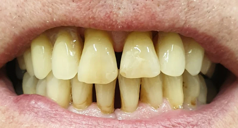 KMO Dental Laboratory - Denture Repairs- New Dentures made - Dental laboratory in Manchester