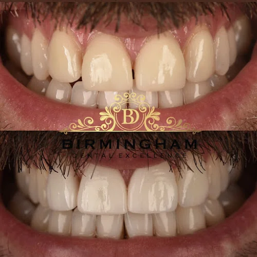 Birmingham Dental Excellence - Dental clinic in Birmingham