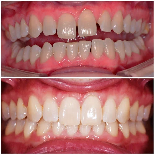 Dr. Kartik Patel | West London Invisalign - Cosmetic dentist in London