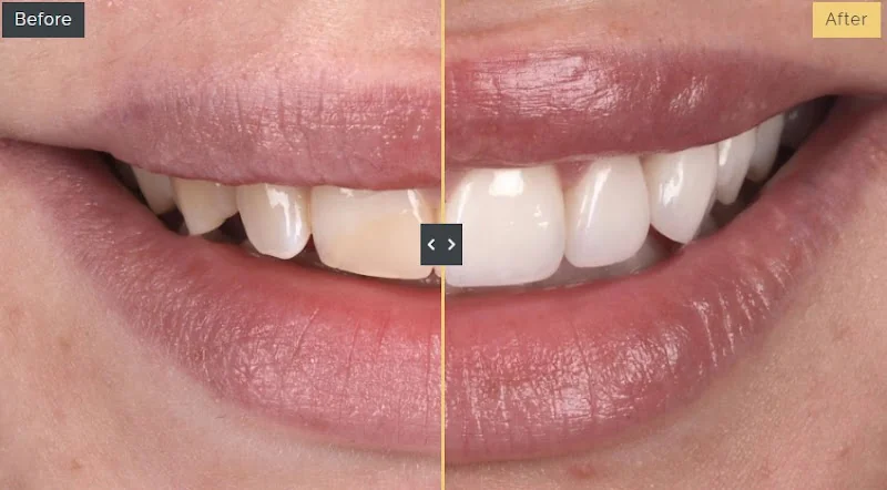 Dr Phil End - Cosmetic dentist in UK