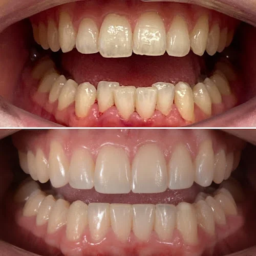 Dr Nik Cosmetic Dental - Dentist in Liverpool