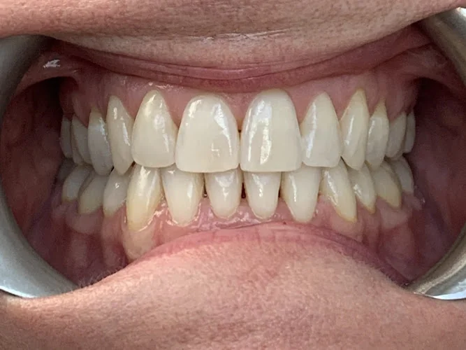 Brixton Smiles - Dentist in London