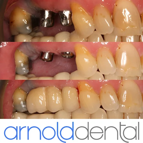 Arnold Dental & Implant Centre - Dental clinic in Nottingham