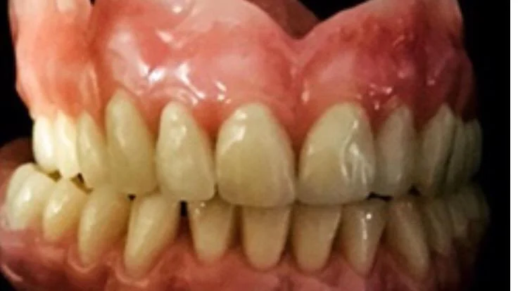 Denture Care Clinic - Dentist in Halesowen