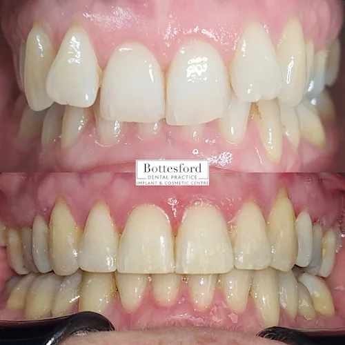 Bottesford Dental Practice - Dental clinic in Scunthorpe