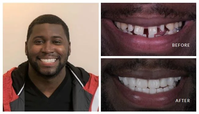 Marylebone Smile Clinic - Cosmetic dentist in London