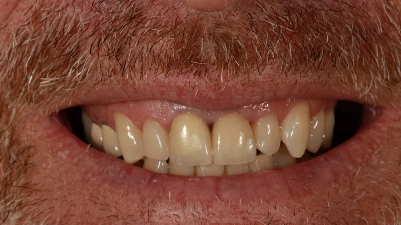 Terrace Dental Care - Dentist in Dawlish