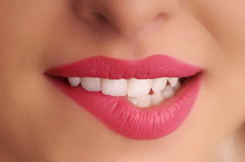 The Toothfairy Laser Teeth Whitening - Teeth whitening service in Dover