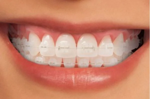 Billericay Orthodontics - Orthodontist in Billericay