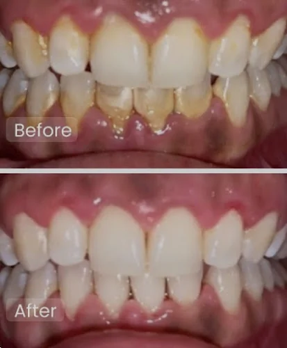 Coxon Dental - Dental hygienist in UK