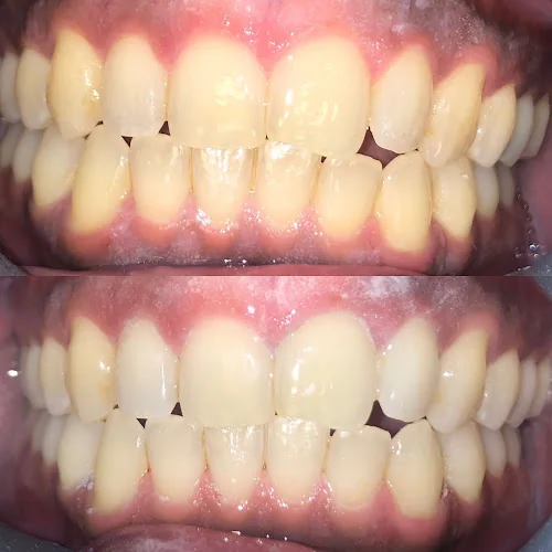 Sarfrazdent - Dental clinic in Birmingham