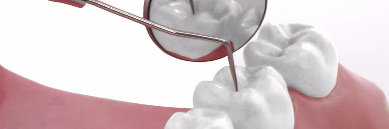 Emergency Dentist Leicester - Dentist in Leicester