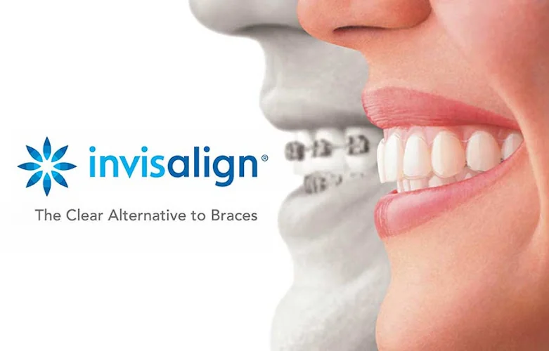 Islington Smiles - Cosmetic dentist in London
