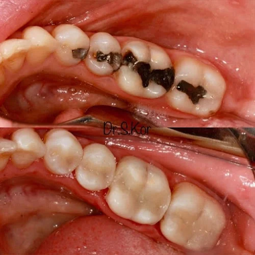 Russell Avenue Dental and Implant Centre - St Albans - Dentist in St Albans