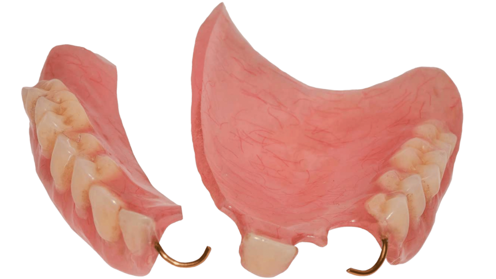 Surrey Denture Repairs - Photo 1