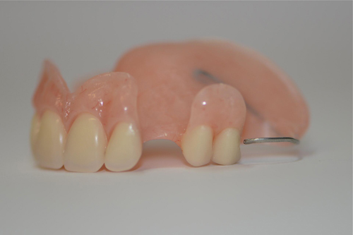 Surrey Denture Repairs - Photo 3