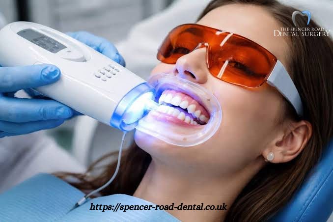 Teeth Whitening Coventry - Photo 1